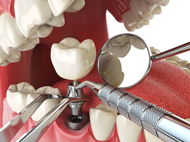 Best Emergency Broken Tooth Repair in Dolgeville, NY